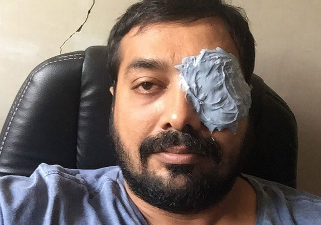 anurag kashyap brawl with mma player