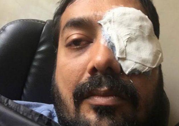 anurag kashyap in  a brawl with a mma player