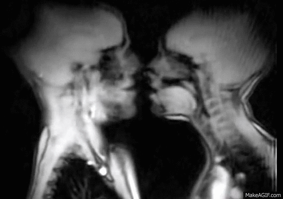 X rays of people having sex X rays of people having sex