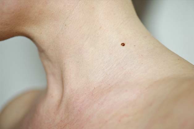 Mole On Left Neck Female Meaning