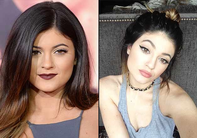 Kylie Jenner Finally Opens Up On Plastic Surgery