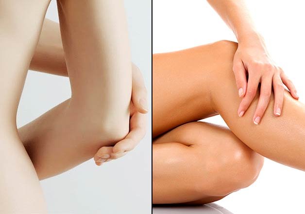 Tips to get rid of dark knees and elbows