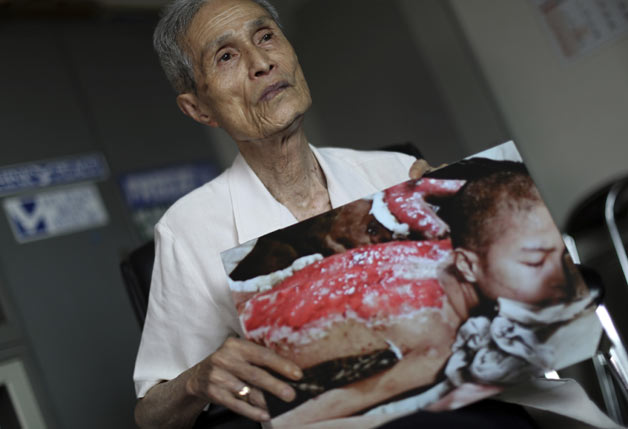 Nagasaki survivor picture