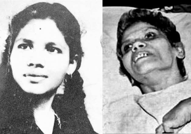 Know Mumbai Nurse Aruna Shanbaug | India TV News