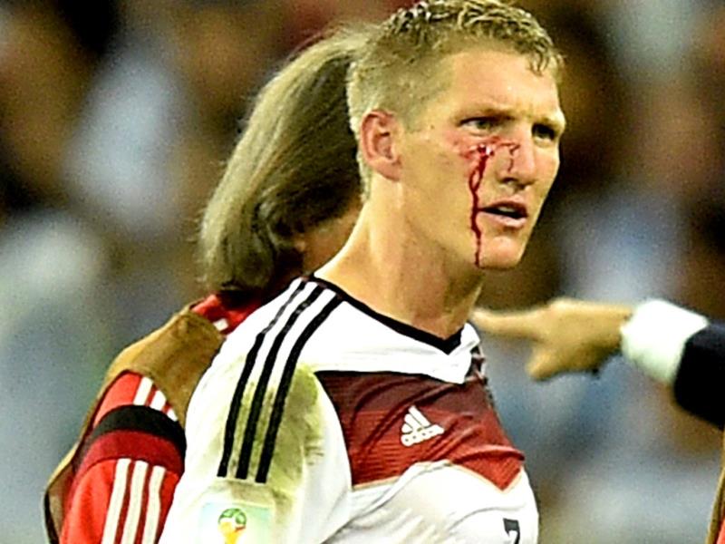 The worst injuries of FIFA World Cup 2014