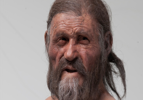 5,300-year-old iceman never cleaned his teeth, had bad breath